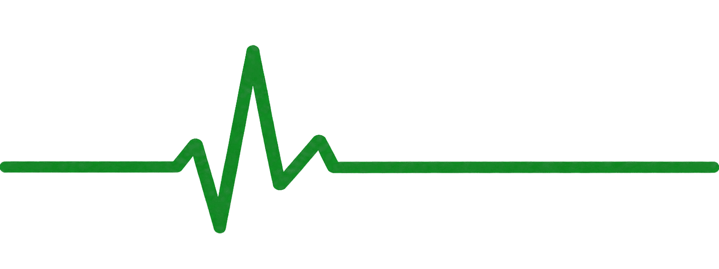 ecg graph